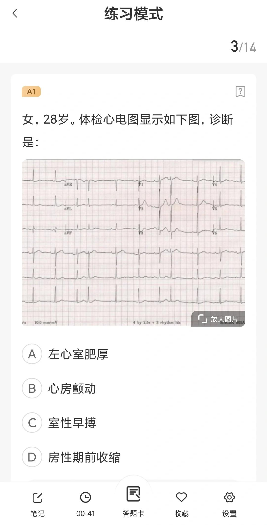 st改变是什么意思(st改变有什么症状)